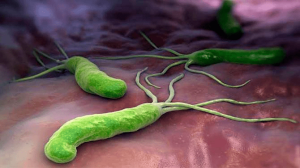 helicobacter-pylori.jpg