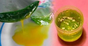 ignis-natura-salud-aloe-vera.jpg