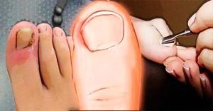 Uñas