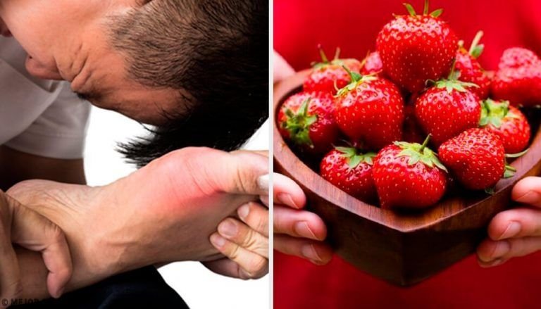 Alimentos que reducen el ácido úrico