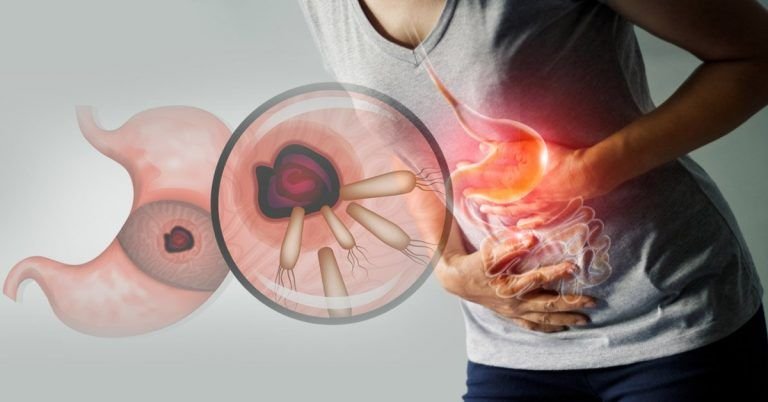 1553005673 archive 1 quelite elimina bacteria gastritis