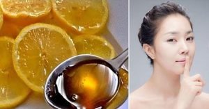 ignis-natura-botox-arrugas