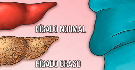 Los 7 alimentos más recomendados para tratar el hígado graso.