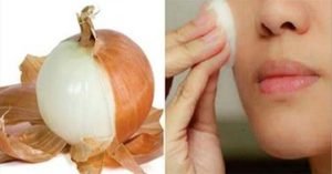ignis-natura-salud-cebolla