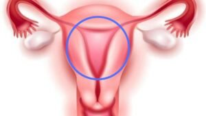 Utero Como se compone y sus tipos 1