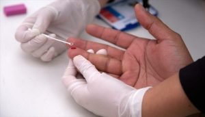 Virus del VIH