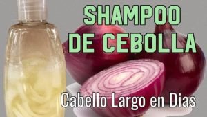 cebolla
