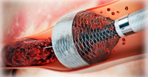 Nanotec