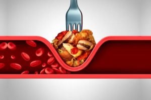 eliminar el azúcar y los triglicéridos