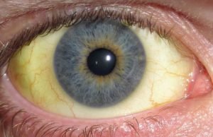 ojos hígado