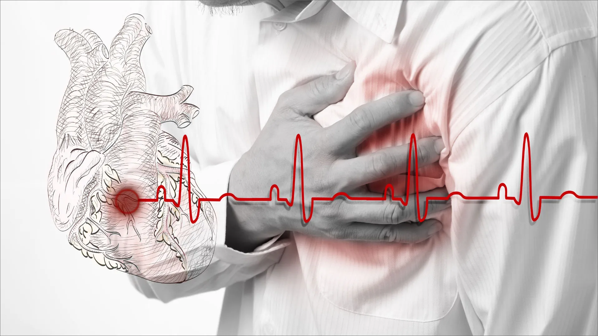 Síntomas de infarto y prevención: ¡Claves para salvar vidas!