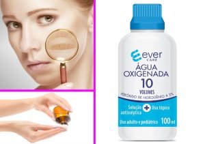 agua-oxigenada-manchas-cara-ignis-natura