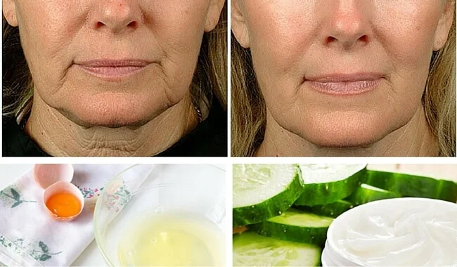 Le llaman el botox casero: elimina manchas y arrugas de la piel con estos ingredientes