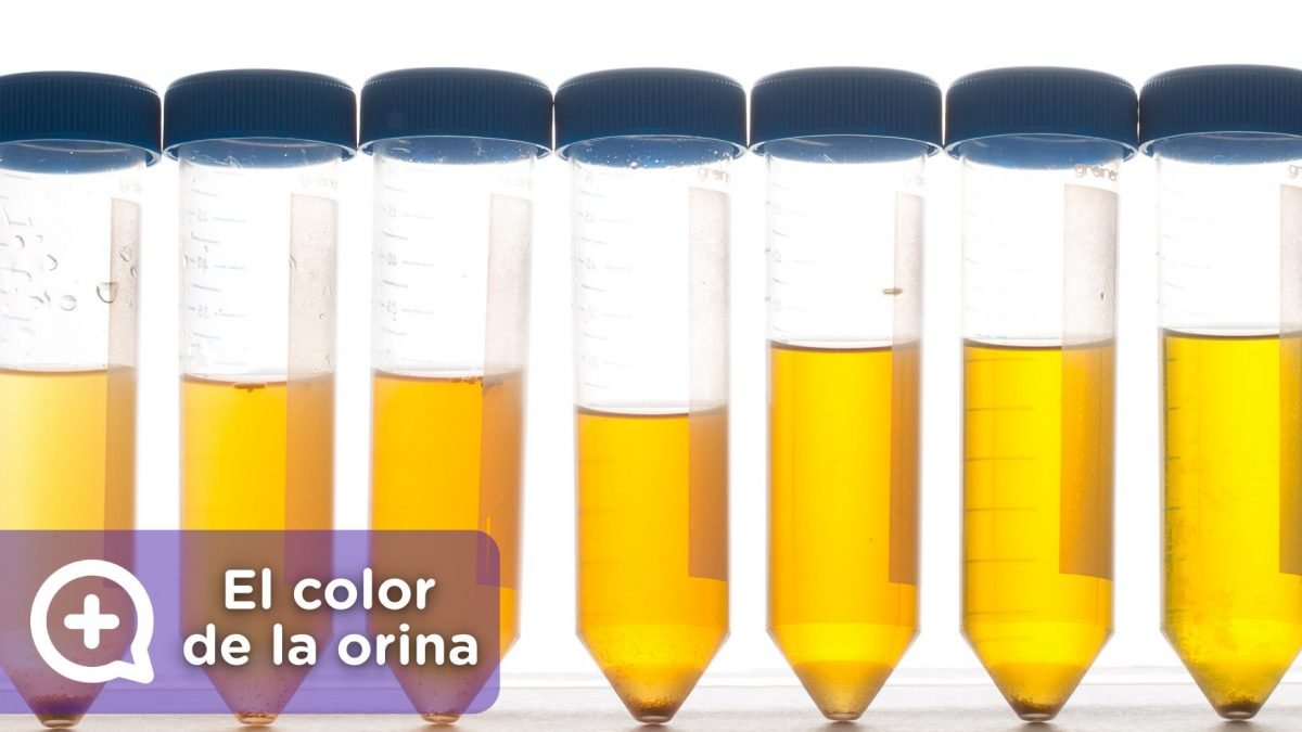 Esto dice el olor y el color de tu orina sobre tu salud: Descúbrelo ahora