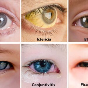 ojos-salud-debes-saberlo-ignis-natura