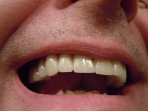 Teeth 414489 640