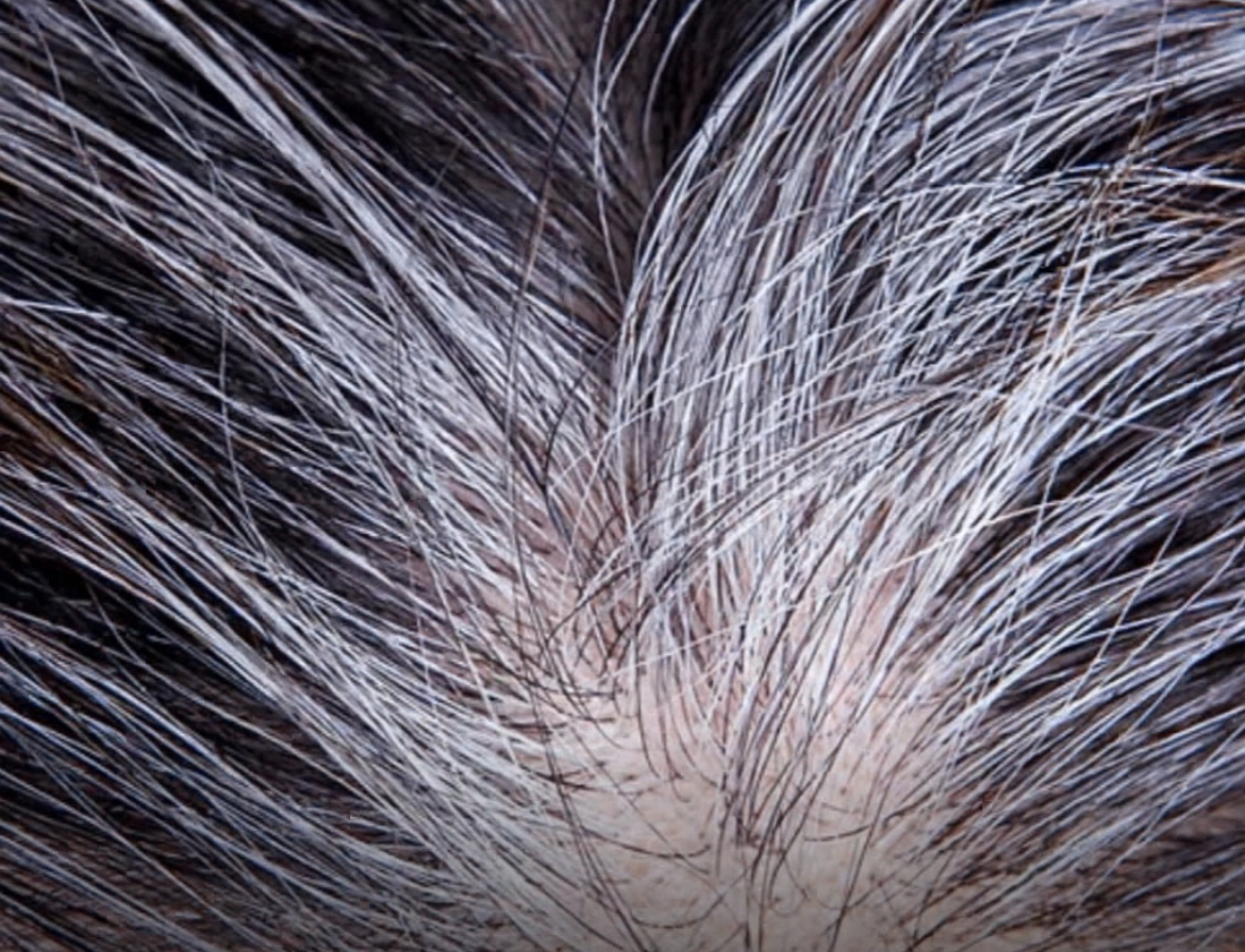 ¿Las canas se pueden revertir? La ciencia responde