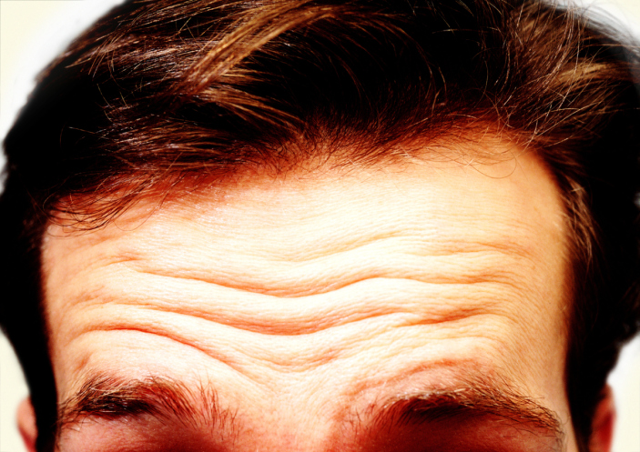 ¿Cuántas líneas tienes en la frente? Esto es lo que significan según la ciencia y la medicina tradicional