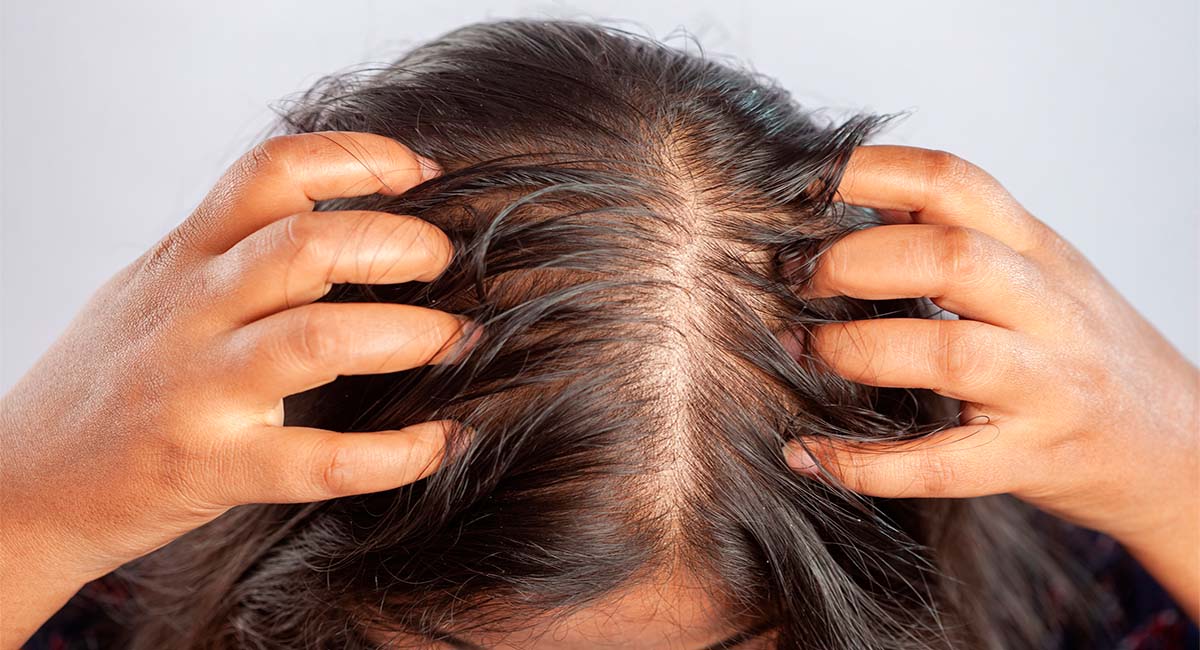 Remedio Natural para la Caída del Cabello: Romero, Aloe Vera y Clavos de Olor