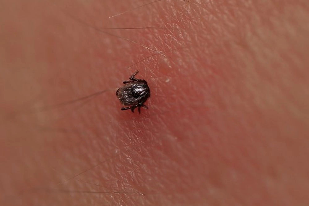Enfermedad de Lyme: causas, tratamiento natural y cómo prevenirla eficazmente