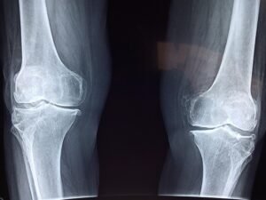 Knee 2253047 640