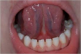 Pon tu lengua en el paladar: 7 beneficios poderosos de este hábito simple que puede mejorar tu vida