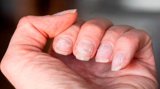 Lo que tus uñas pueden decir sobre tu salud