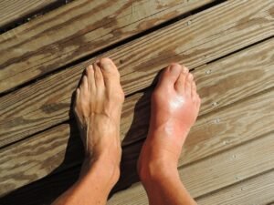 Ardor, hormigueo y adormecimiento en los pies: ¿qué puede significar?