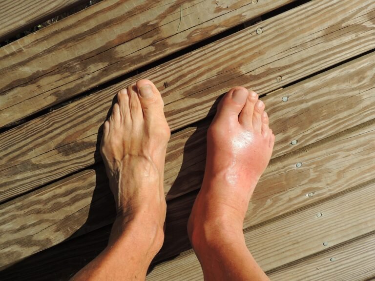 Ardor, hormigueo y adormecimiento en los pies: ¿qué puede significar?